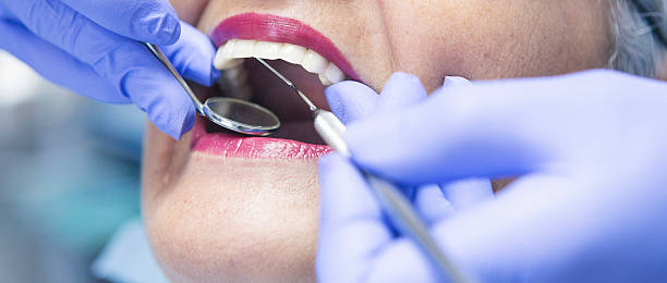 Best Emergency Root Canal Treatment in Buna, TX